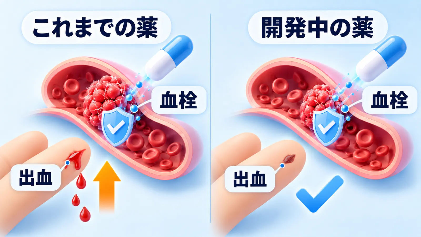左右2場面の対比図。左「これまでの薬」も右「開発中の薬」も、血管の断面の中にある血のかたまり（血栓）を、カプセルから届く青い盾がおさえている。違いは指先の小さな切り傷だけで、左は赤いしずくが3つ落ちてオレンジの上向き矢印（出血が増える）、右はかさぶたでふさがり青いチェックマーク（出血は増えない）。ラベルは「これまでの薬」「開発中の薬」「血栓」「出血」