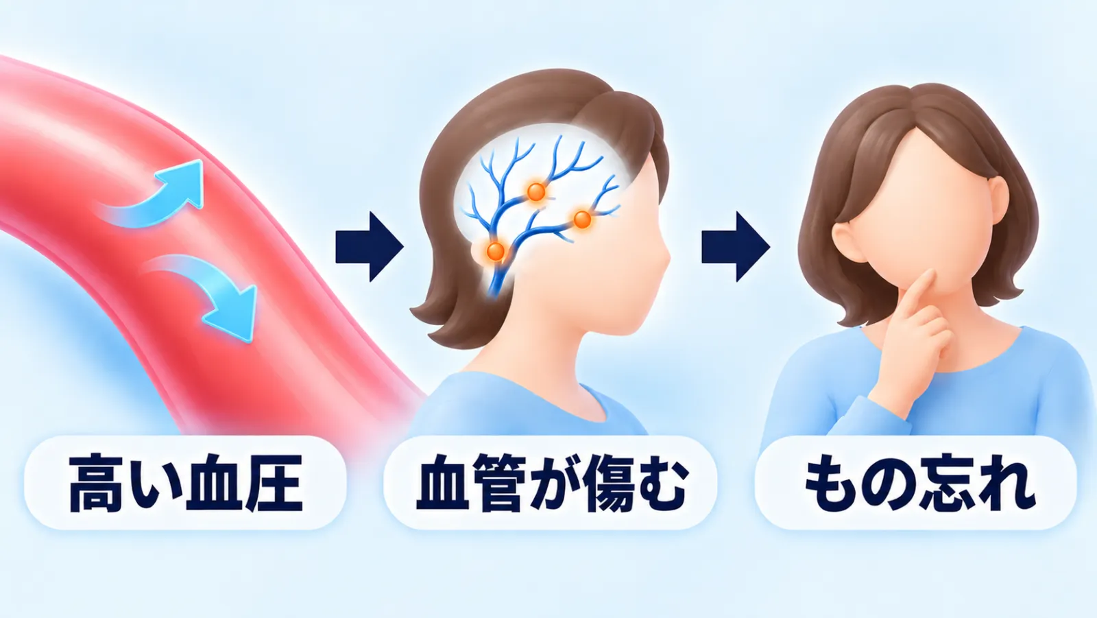 左から右へ3コマの流れ図。左は赤い血管の一部を斜めに描き、その中に内側から壁を押す水色の矢印が2本あり「高い血圧」。中央は同じ女性の横顔で、頭の中に枝分かれした細い血管が描かれ、3か所にオレンジの丸い点があり「血管が傷む」。右は同じ女性が片手を口元に当てて少し首をかしげ「もの忘れ」。コマとコマは右向きの濃い紺色の矢印でつながっている