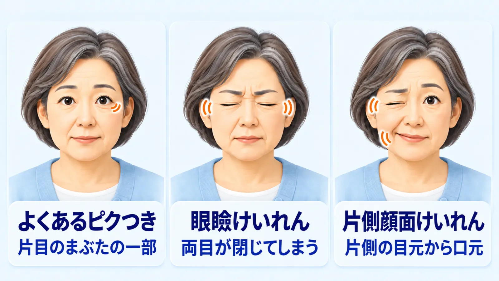 同じ女性の顔のアップを3つ並べ、顔のピクピクの見分け方を示した図。「よくあるピクつき」＝片目の下まぶたの一部だけが細かく動く。「眼瞼けいれん」＝両目がぎゅっと閉じてしまう。「片側顔面けいれん」＝片側だけ、目を細くつぶり同じ側の口元が引かれる。