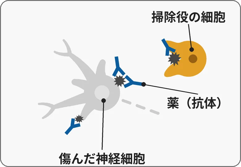 神経細胞に付いたかたまりは小さくなり、Y字の形の薬（抗体）がくっついている。黄色い掃除役の細胞が、薬のくっついたかたまりを2本の腕で抱え込んで片付けている絵。神経細胞は灰色の傷んだまま。